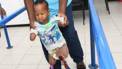 Photo of Jamaican baby born without limbs takes first steps