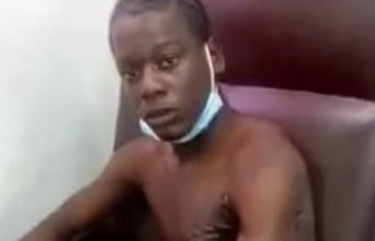 Photo of Teen says was burnt by cops at Vigilance station – -police have different version
